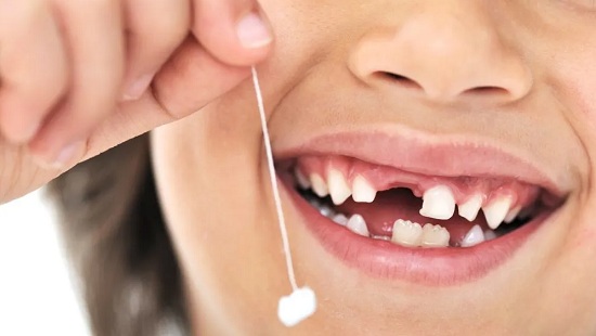 удаление молочных зубов